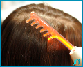 Дарсонвализация волосистой части головы за 300 руб.